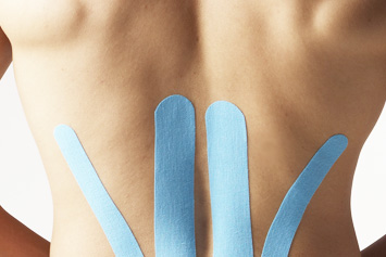 Kinesio-Taping-Therapie